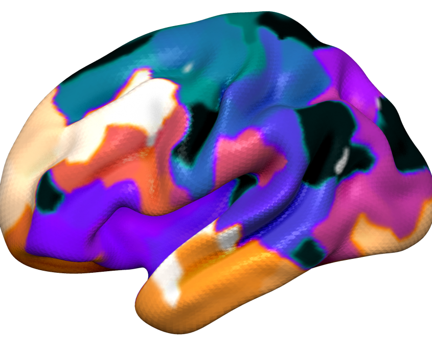 Cortical Atlas Parcellations (MNI-Space) – Lead-DBS